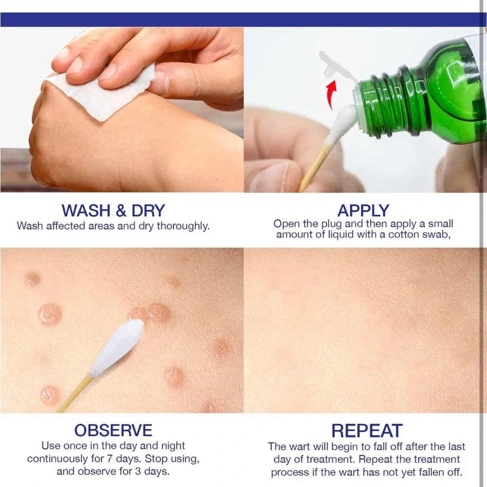 NEW Dr. Luke Liquid Wart Remover Treatment Fast Acting